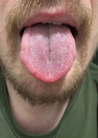 minetke, 69, pissing, facesitting, squirt, plucie